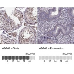 WDR63 Antibody, Novus Biologicals 25 &mu;L, Unlabeled:Antibodies, Polyclonal